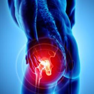 Rehabilitation for Hip Pain: A PTA's Perspective